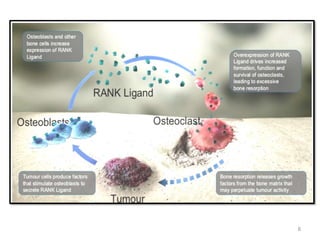 Bone Mets Types Bone metastasis | PPT