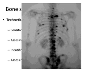 Bone scanning
• Technetium-99m (99m Tc) bone scanning:
– Sensitive for detection of occult lesions
– Assessment of the biologic activity of lesions
– Identification of other sites
– Assessing response to therapy
 