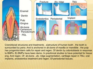 Enamel
Dentin
Pulp
Gingiva
Alv.bone
Cementum
Periodontium
PDL
Fracture Alv. ridge TMJ
Endodontics Periodontal Implant
Craniofacial structures and treatments . a)structure of human tooth . the tooth is
surrounded by perio. And is anchored in alv.bone of maxilla or mandible . the pulp
has progenitor/stem cells for repair and regen. Of dentin by odontoblasts in response
to BMPs. B) BMPs have been demo. In preclinical studies to have potential for tissue
eng. And regen. Of alv.bone , alv. ridge augmentation, cartilage repair in TMJ, oral
implants, endodontics treatment and regen. Of periodontal tissues.
 