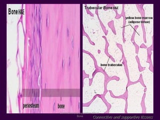 Connective and supportive tissues
Connective and supportive tissue -
Bone
 