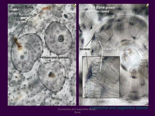 Connective and supportive tissuesConnective and supportive tissue -
Bone
 