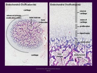 Connective and supportive tissue -
Bone
 