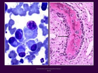 Connective and supportive tissue -
Bone
 