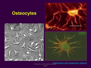 Connective and supportive tissues
Osteocytes
Connective and supportive tissue -
Bone
 