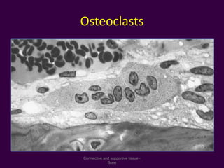 Osteoclasts
Connective and supportive tissue -
Bone
 