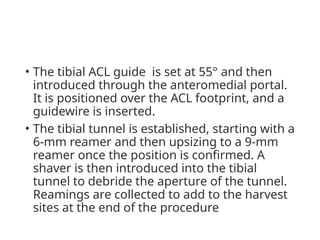 Comprehensive Guide to Bone-Patellar Tendon-Bone ACL Graft ...