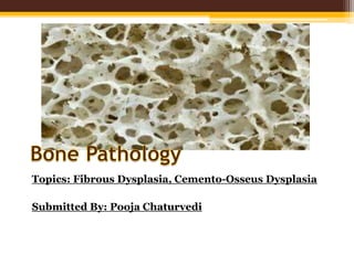 Topics: Fibrous Dysplasia, Cemento-Osseus Dysplasia
Submitted By: Pooja Chaturvedi
 