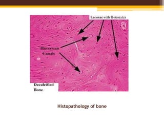 Histopathology of bone
 