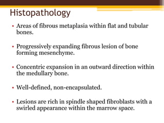 Histopathology
• Areas of fibrous metaplasia within flat and tubular
bones.
• Progressively expanding fibrous lesion of bone
forming mesenchyme.
• Concentric expansion in an outward direction within
the medullary bone.
• Well-defined, non-encapsulated.
• Lesions are rich in spindle shaped fibroblasts with a
swirled appearance within the marrow space.
 