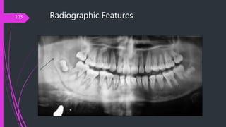 Radiographic Features103
 