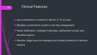 Clinical Features
 Jaw involvement is present in almost 17 % of cases
 Maxillary involvement results in mid face enlarge...