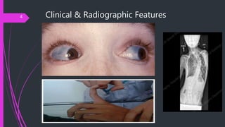 Clinical & Radiographic Features4
 