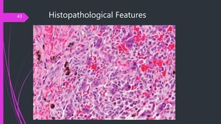 Histopathological Features43
 