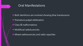 Oral Manifestations
Both dentitions are involved showing blue translucence
Premature pulpal obliteration
Class III malf...