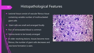 Histopathological Features
 Lesional tissue consist of vascular fibrous tissue
containing variable number of multinucleat...