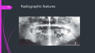 Radiographic features78
 