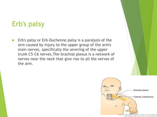 Erb's palsy
 Erb's palsy or Erb–Duchenne palsy is a paralysis of the
arm caused by injury to the upper group of the arm's
main nerves, specifically the severing of the upper
trunk C5–C6 nerves.The brachial plexus is a network of
nerves near the neck that give rise to all the nerves of
the arm.
 