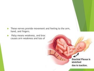  These nerves provide movement and feeling to the arm,
hand, and fingers.
 Palsy means weakness, and brachial plexus birth palsy
causes arm weakness and loss of motion.
 