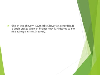  One or two of every 1,000 babies have this condition. It
is often caused when an infant's neck is stretched to the
side during a difficult delivery.
 