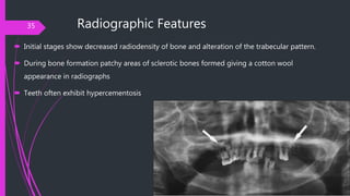 Bone pathology | PPTX