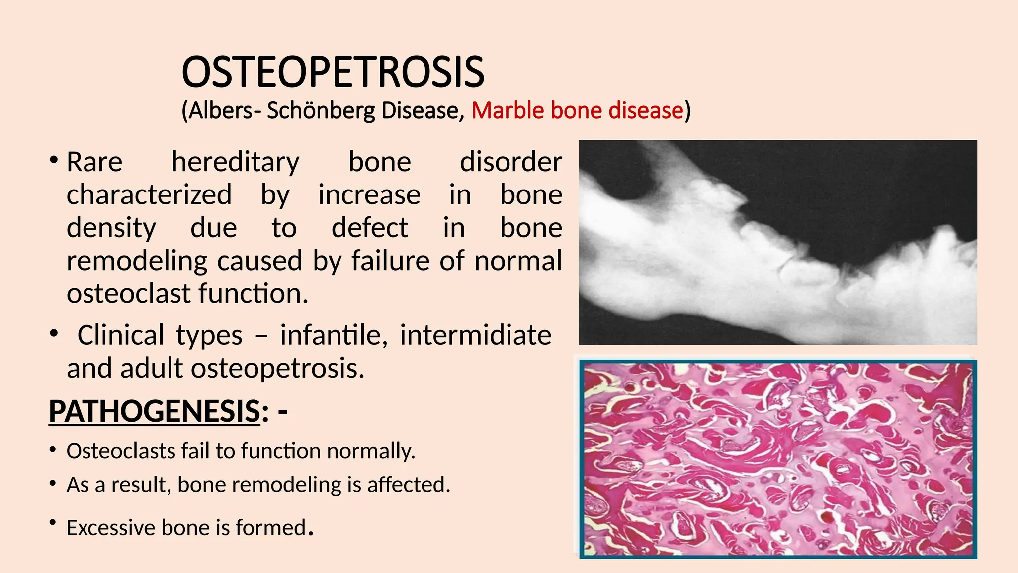 BONE PATHOLOGY / DISEASE OD BONE & JOINTS.pptx