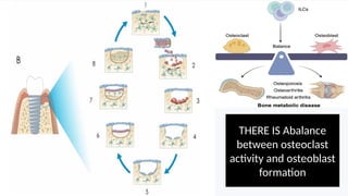 BONE PHYSIOLOGY AND BONE METABOLISM REGARDING IMPLANT THERAPY.pptx