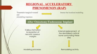 bone physiology and metabolism orthodontics | PPTX