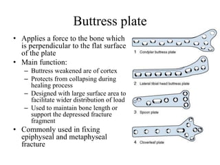 Buttress plate
• Applies a force to the bone which
is perpendicular to the flat surface
of the plate
• Main function:
– Buttress weakened are of cortex
– Protects from collapsing during
healing process
– Designed with large surface area to
facilitate wider distribution of load
– Used to maintain bone length or
support the depressed fracture
fragment
• Commonly used in fixing
epiphyseal and metaphyseal
fracture
 