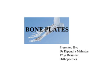 BONE PLATES
Presented By:
Dr Dipendra Maharjan
1st yr Resident,
Orthopaedics
 