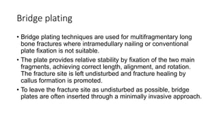Bridge plating
• Bridge plating techniques are used for multifragmentary long
bone fractures where intramedullary nailing or conventional
plate fixation is not suitable.
• The plate provides relative stability by fixation of the two main
fragments, achieving correct length, alignment, and rotation.
The fracture site is left undisturbed and fracture healing by
callus formation is promoted.
• To leave the fracture site as undisturbed as possible, bridge
plates are often inserted through a minimally invasive approach.
 