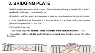 BONE PLATES ORTHOPEDIC SEMINAR AIIMS JODHPUR | PPTX