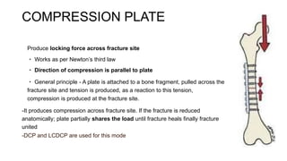 BONE PLATES ORTHOPEDIC SEMINAR AIIMS JODHPUR | PPTX