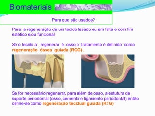 BiomateriaisPara que são usados?Para  a regeneração de um tecidolesadoouemfalta e com fimestético e/oufuncionalSe o tecido a   regenerar  é  osso o  tratamento é definidocomoregeneraçãoósseaguiada (ROG) .Se for necessárioregenerar, paraalém de osso, a estutura de suporte periodontal (osso, cemento e ligamento periodontal) então define-se comoregeneraçãotecidualguiada (RTG)