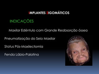 IMPLANTES ZIGOMÁTICOS     INDICAÇÕESMaxilar Edéntulo com Grande Reabsorção óssea		Pneumatização do Seio Maxilar	Status Pós-Maxilectomia	Fenda Lábio-Palatina