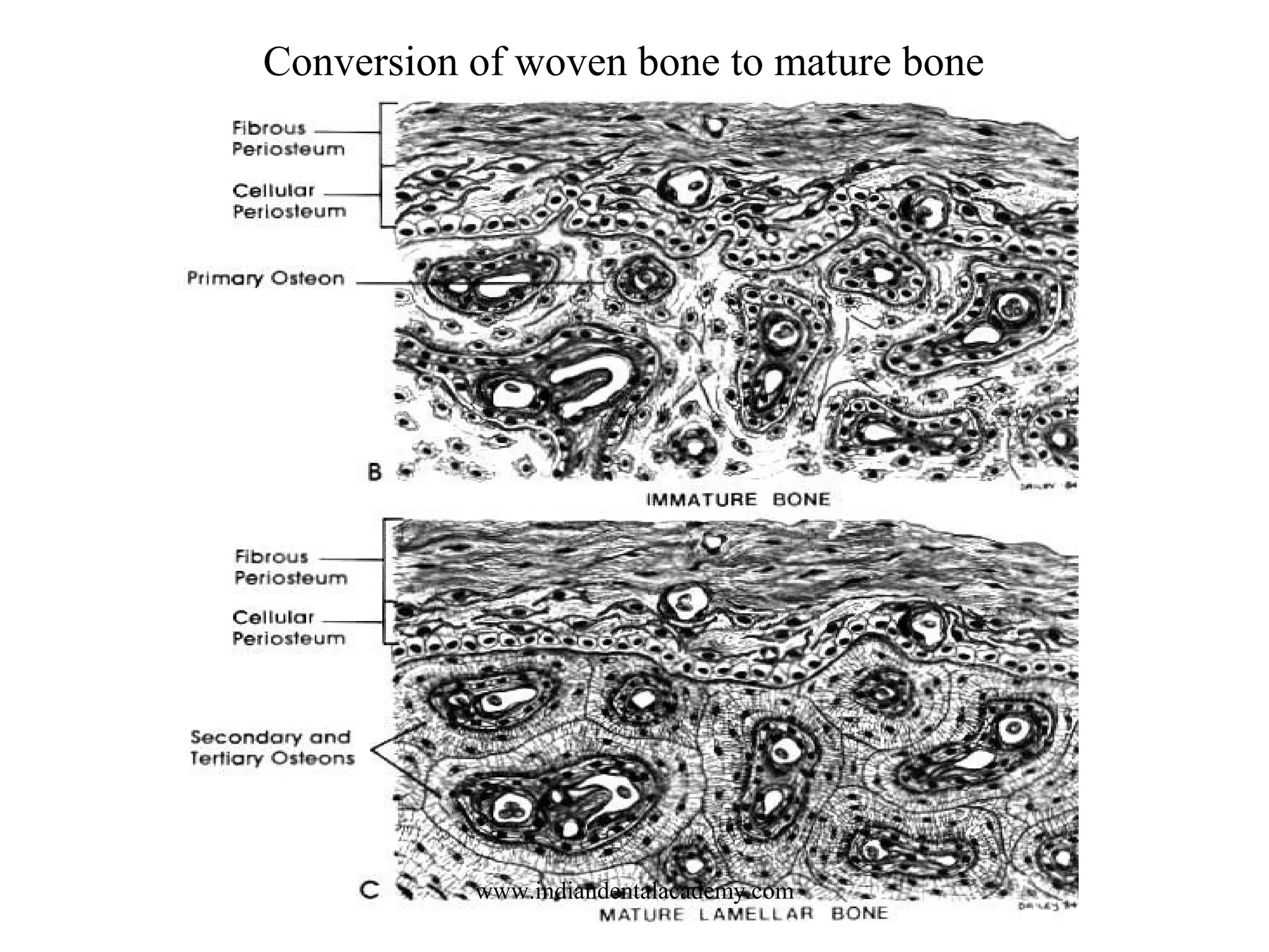 Conversion of woven bone to mature bone
www.indiandentalacademy.com
 