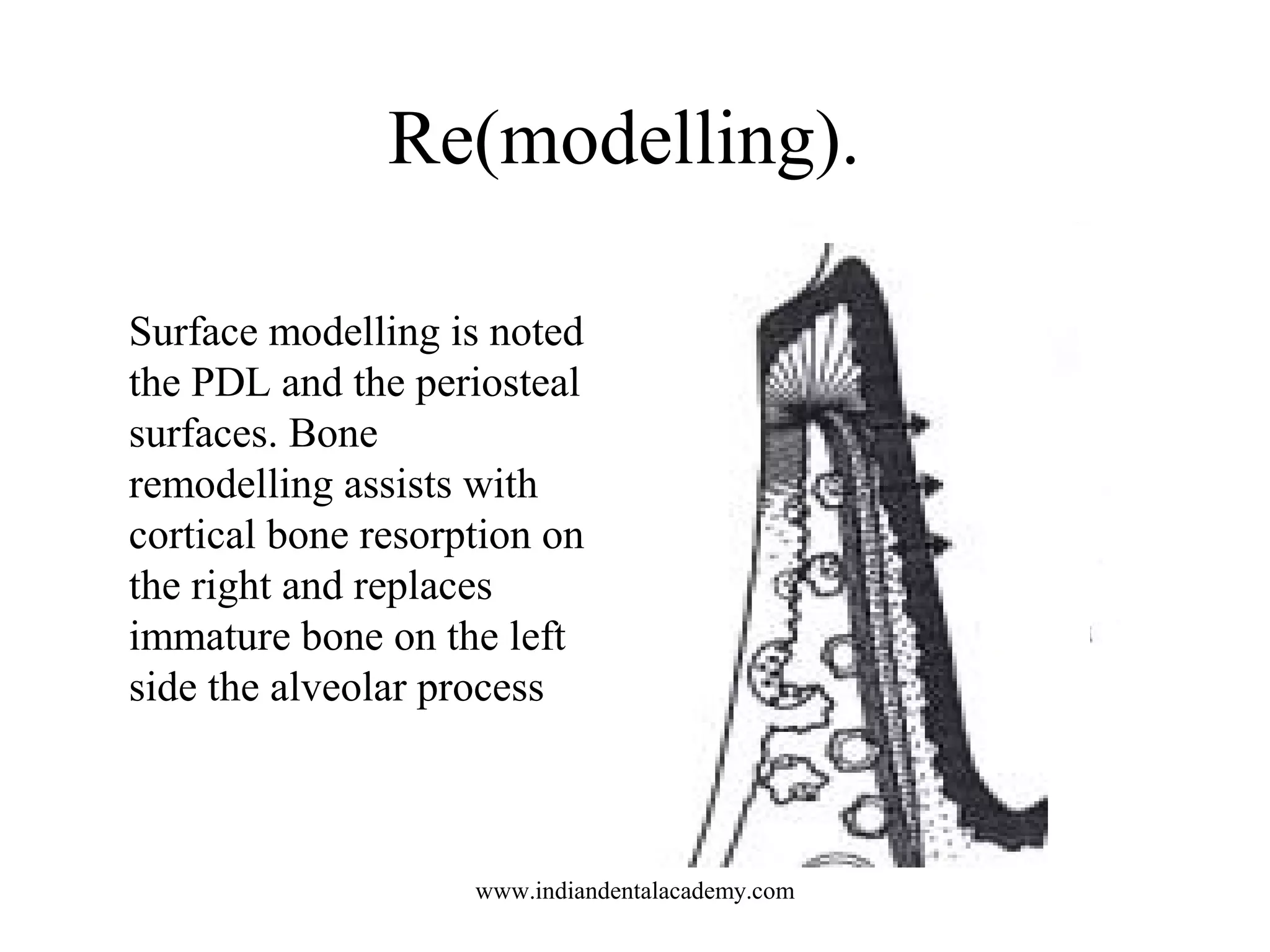 Re(modelling).
Surface modelling is noted
the PDL and the periosteal
surfaces. Bone
remodelling assists with
cortical bone resorption on
the right and replaces
immature bone on the left
side the alveolar process
www.indiandentalacademy.com
 