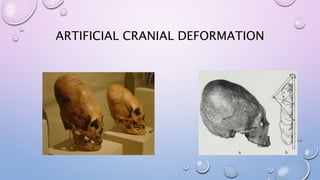 ARTIFICIAL CRANIAL DEFORMATION
 