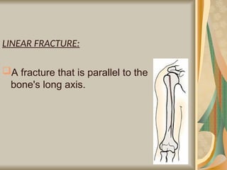 Parallel Medium Bone Comprehensive Overview of Bone Structure, Formation, and Joint Types | PPT