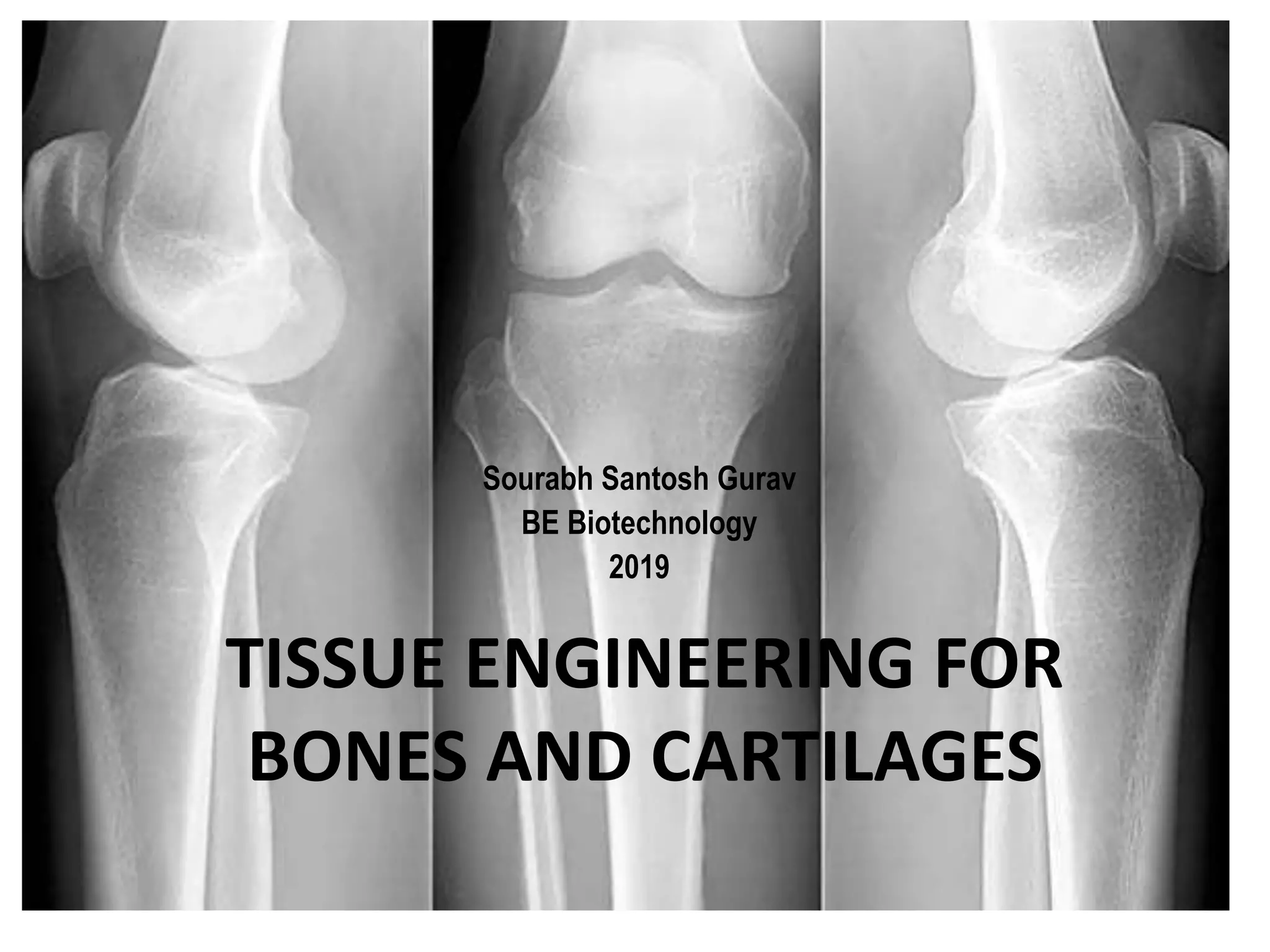 Bones and cartilages tissue engineering | PPTX