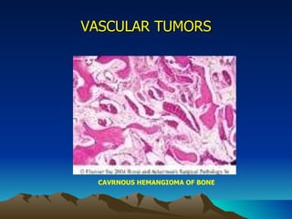 VASCULAR TUMORS CAVRNOUS HEMANGIOMA OF BONE 