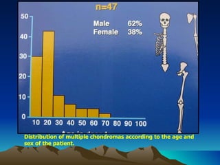 Distribution of multiple chondromas according to the age and sex of the patient. 