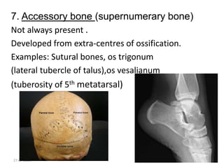 bones and type.pptx
