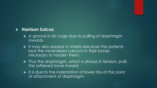 Bones (applied physiology) | PPTX