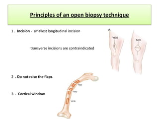 Principles of an open biopsy technique
1 . Incision - smallest longitudinal incision
transverse incisions are contraindicated
2 . Do not raise the flaps.
3 . Cortical window
 
