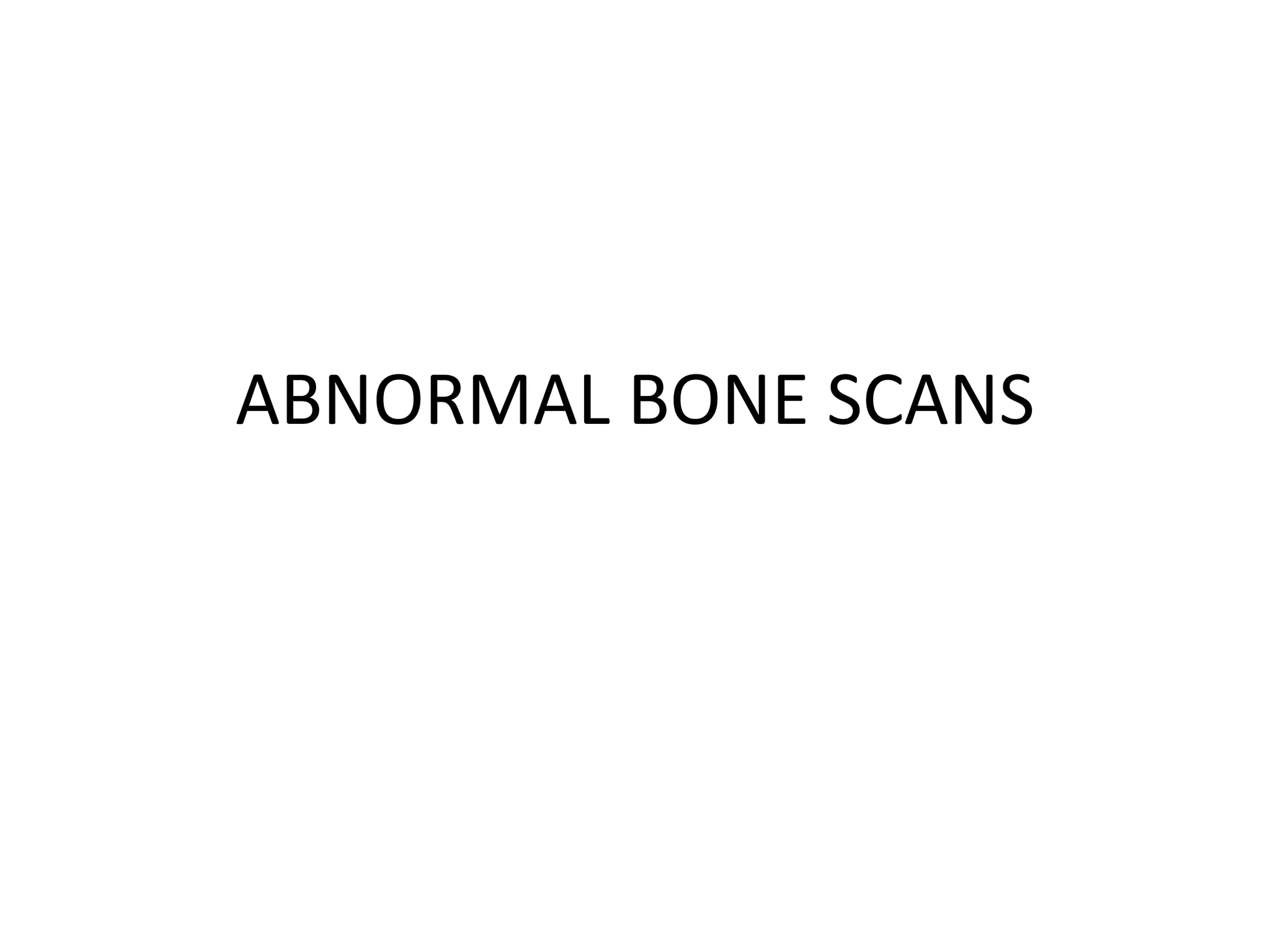 ABNORMAL BONE SCANS
 