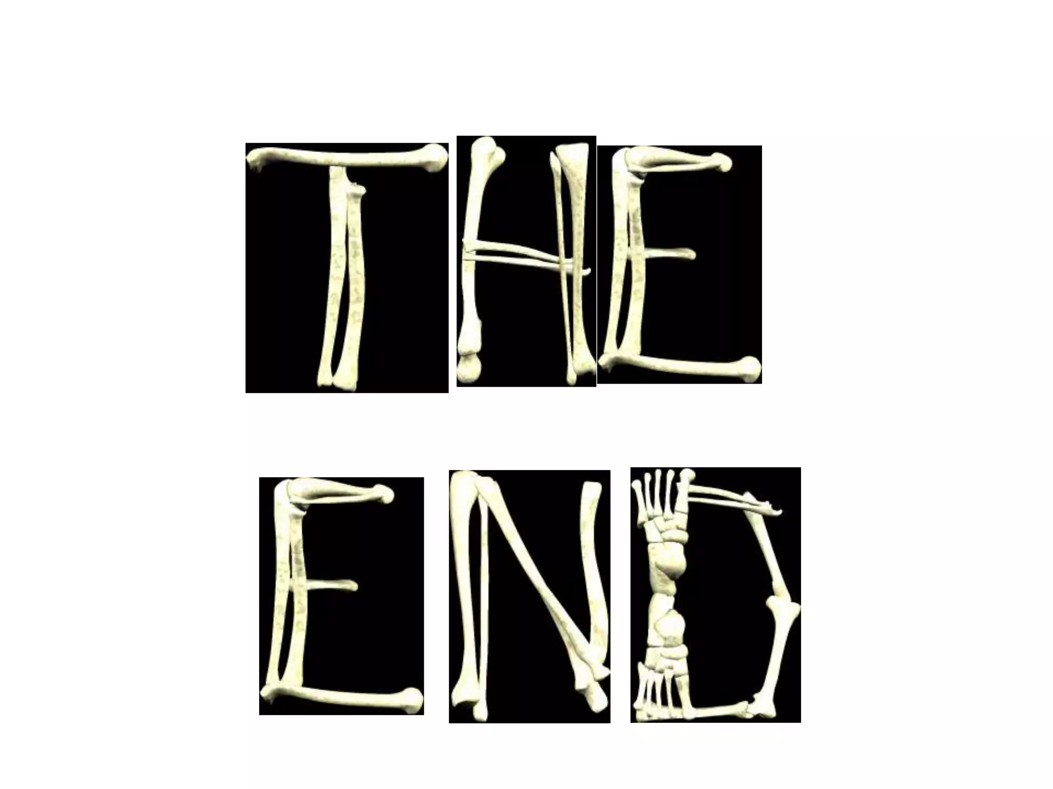 Bone scan in Orthopaedics