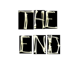 Bone scan in Orthopaedics