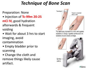 Technique of Bone Scan
Preparation: None
• Injection of Tc-99m 20-25
mCi IV, good hydration
afterwards & frequent
voiding
• Wait for about 3 hrs to start
imaging, avoid
contamination
• Empty bladder prior to
scanning
• Change the cloth and
remove things likely cause
artifact.
 
