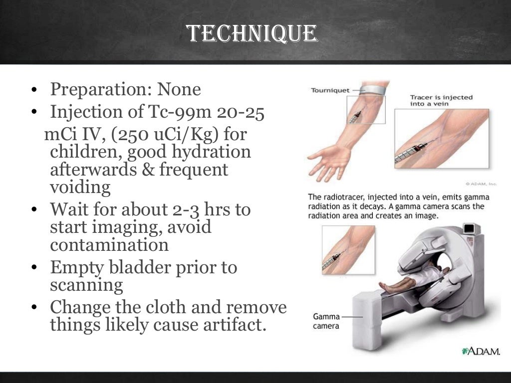 Bone scan