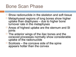 Bone Scan Phase
 Show radionuclide in the skeleton and soft tissue
 Metaphyseal regions of long bones show higher
uptake than diaphyses – due to higher bone
turnover rate in the metaphyses
 Areas of highest uptake are the sternum and SI
joints
 The anterior wings of the iliac bones and the
coracoid processes normally show considerable
uptake of the radionuclide
 Scoliosis – the concave side of the spine
appears hotter than the convex
 